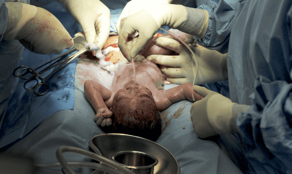Your Child Suffered a Serious Birth Injury – Important Next Steps